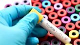 As congenital syphilis rates soar in Michigan and US, CDC urges screening, treatment
