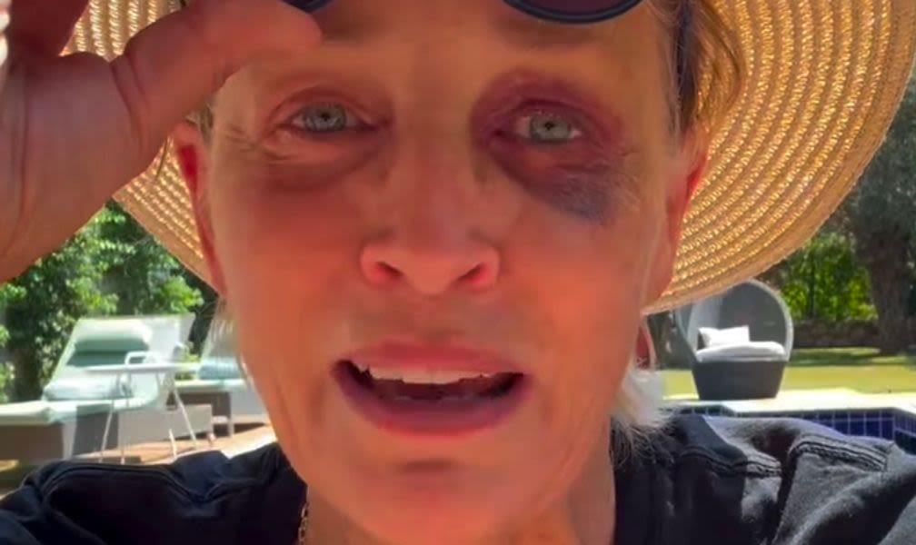 Sharon Stone Shows Off Shiner To Reassure Concerned Fans: 'I Know You're All Worried'