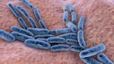 A microbiome transplant could help people with bacterial vaginosis : Short Wave