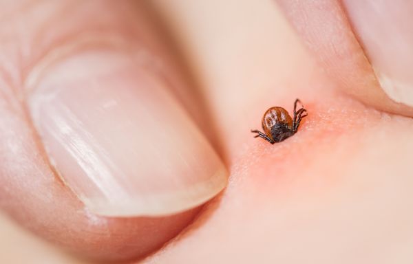 Tick season: What to know about Lyme disease as 'more resilient' ticks this year as parts of Canada see double-digit temperatures