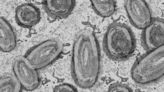 New research defines specific genomic changes associated with the transmissibility of the mpox virus