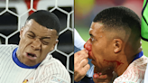 The night Kylian Mbappe broke his nose at Euro 2024 - 'Any ideas for masks?'