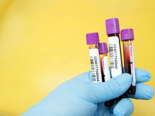 Panel recommends blood test to detect colon cancer for FDA approval