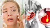 Early Signs Of Stomach Cancer Visible On Your Face You Must Not Ignore