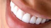 Coffee drinkers swear by £25 teeth whitening solution and it's buy 2 get 1 free