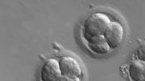 Most human embryos naturally die after conception – restrictive abortion laws fail to take this embryo loss into account