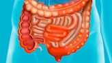 'Major cause’ of inflammatory bowel disease discovered by researchers