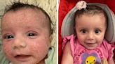 Mum says she has ‘completely different baby’ after £7.99 cream helped painful eczema