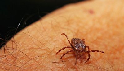 Man dies after contracting lethal 'bleeding eyes' disease from tick bite