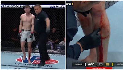 Jack Shore's gruesome leg injury at UFC 301 led to one of the most bizarre fight endings ever