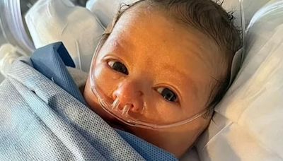 My baby boy died at 2 months old after his skin began to slide off his body