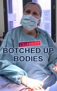 Celebrity Botched Up Bodies