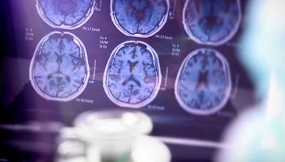 Falling behind on bills may be early sign of dementia: Study