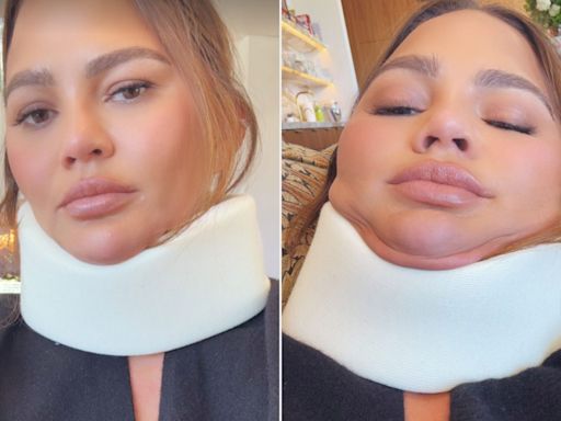 Chrissy Teigen Models a Neck Brace and Jokes She Skipped the 2024 Met Gala Because a Headstand 'Didn’t Go Well'