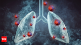 Non-smokers at risk: The reality of lung cancer without tobacco - Times of India