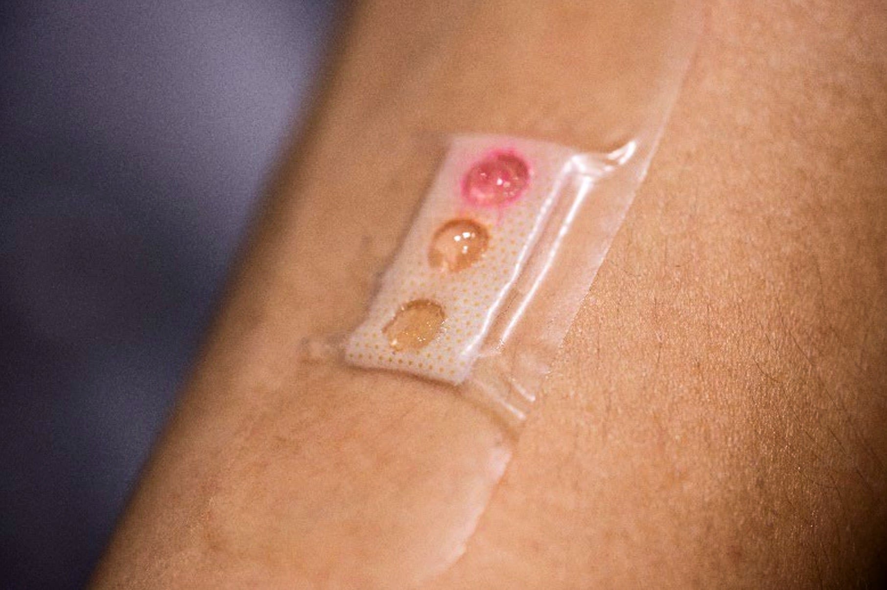 This tiny patch could be the future of wearable technology
