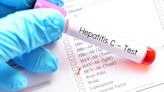 Estos síntomas pueden indicar que tienes hepatitis C