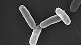 La OMS publica la lista de las 15 bacterias más peligrosas para la salud humana