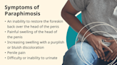Treatment to Resolve Paraphimosis