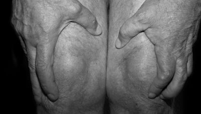 This Common Condition Can Damage Joints Long Before It’s Detected