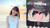 陳嘉慧結婚兩月內宣布懷孕 TVB小花IG晒超聲波照：我們仨 | am730