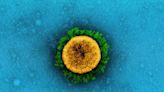 It’s Taken 100 Scientists Two Years to Rename Airborne Viruses After Covid Mistakes