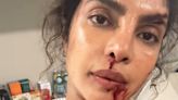 Priyanka Chopra flaunts bruises she sustained during shoot in The Bluff BTS
