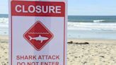 Woman speaks out from hospital bed after apparent shark attack in Southern California