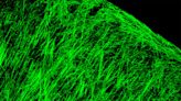 Small molecule shows early-stage promise for repairing myelin sheath damage