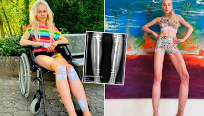 La historia de la modelo alemana que gastó USD 162.000 para alargarse las piernas por pedido de su ex esposo
