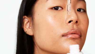 Over Your Melasma? Here's *Exactly* How to Get Rid of It