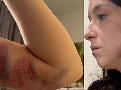 Una azafata irlandesa podría ir a prisión en Dubái luego de ser atacada por su marido