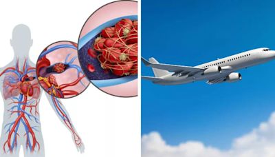 Do Frequent International Flyers Run The Risk Of Blood Clots? All About The Dangers Of Pulmonary Embolism
