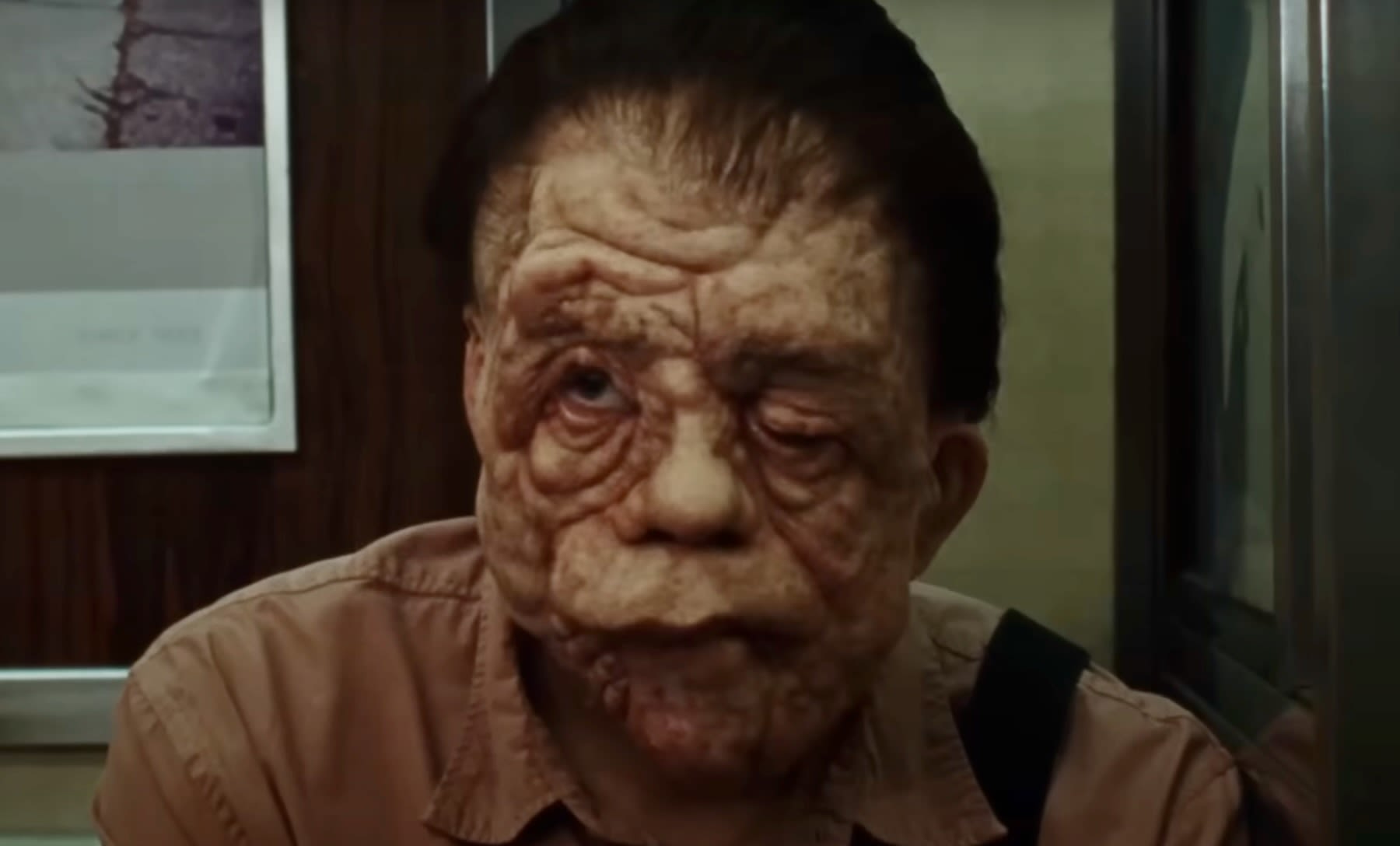 Sebastian Stan Undergoes a Radical Transformation in A24’s A Different Man Trailer: Watch