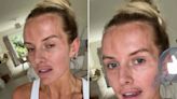 Love Island’s Faye Winter bravely shows off her ‘real skin’