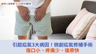 引起疝氣3大病因！微創疝氣修補手術傷口小、疼痛少、復原快 | 蕃新聞