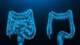 New treatment may extend survival for people with advanced colon cancer - UPI.com