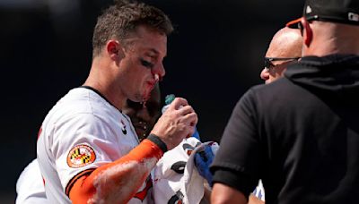 Orioles' James McCann stays in game after taking fastball to his face