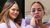 Chrissy Teigen Shares Honest Health Video: ’The Face of a Double Ear Infection’