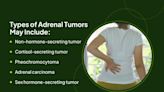 Signs and Symptoms of Adrenal Cancer