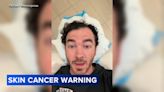 'Get those moles checked, people!': Kevin Jonas gets surgery to remove skin cancer