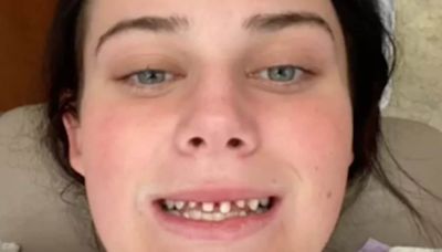 Woman’s Regular Appointment Turns Into Nightmare After Dentist 'Shaves Off' Her Teeth - News18