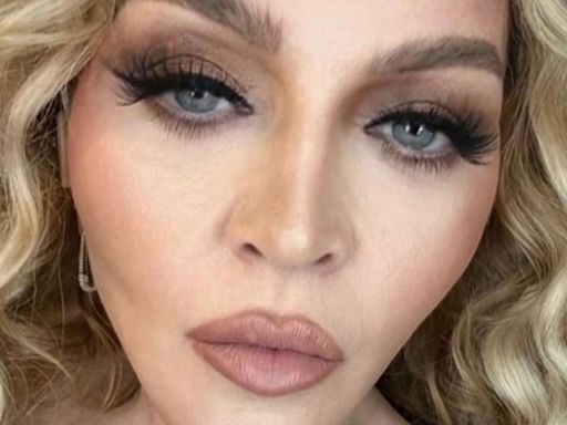 Madonna is on a 'surgery hiatus' except for 'noticeable' $15k lip changes