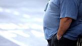 Obesity surgery is most effective way of preventing premature deaths