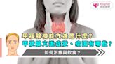 甲狀腺機能亢進是什麼？甲狀腺亢進症狀、病因有哪些？如何治療與飲食？