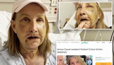 Crazed homeless man brutally beats two women in California, leaving one in coma: ‘Like being hit by a truck’