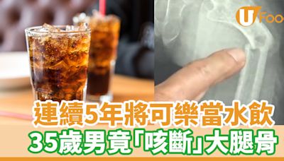 連續5年將可樂當水飲 35歲男竟「咳斷」大腿骨 | U Food 香港餐廳及飲食資訊優惠網站