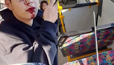 16-year-old Chinese boy beat with iron rod on New Zealand bus