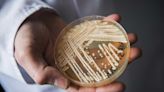 美國爆真菌感染 1/3患者感染90天內死亡