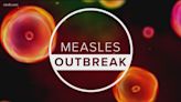 San Diego County confirms third case of measles this year
